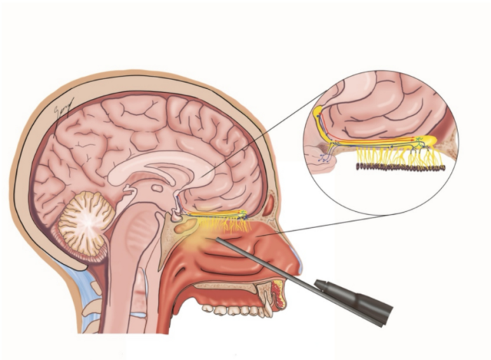 Potential Endocrine Dysfunction Following Skull Base Surgery