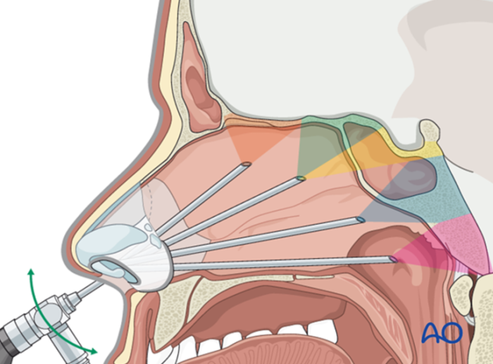 The Evolution of Skull Base Surgery Techniques