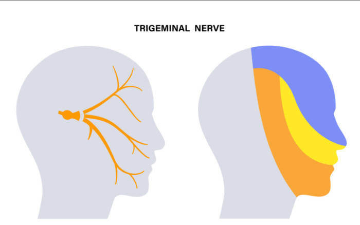 Can Trigeminal Neuralgia Be Inherited?