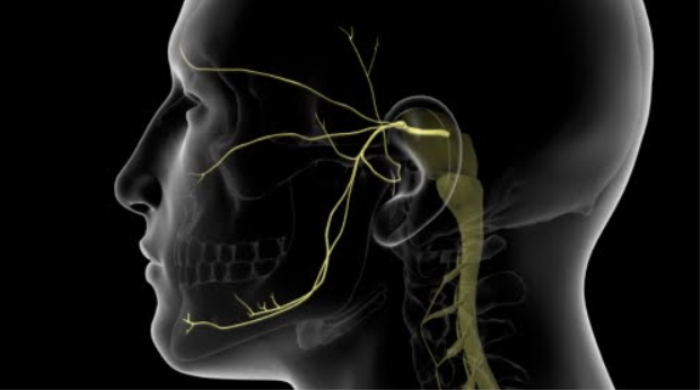 Why Is Microvascular Decompression Considered the Gold Standard for Trigeminal Neuralgia?