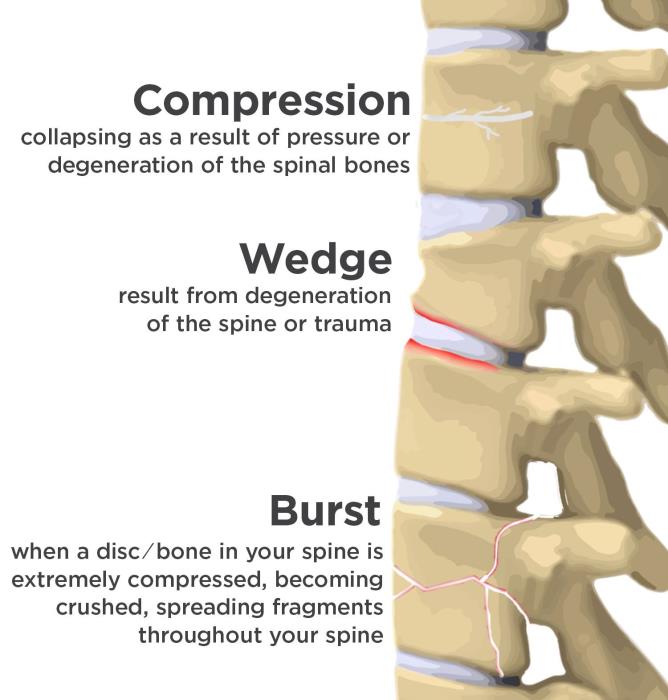 Best Hospital for spinal cord surgeries in India