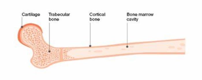 Characteristics of Primary Bone Cancer