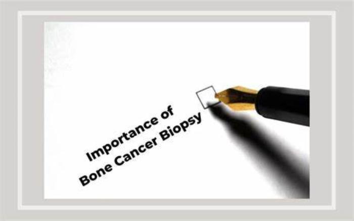 What is a Biopsy in the Context of Bone Cancer