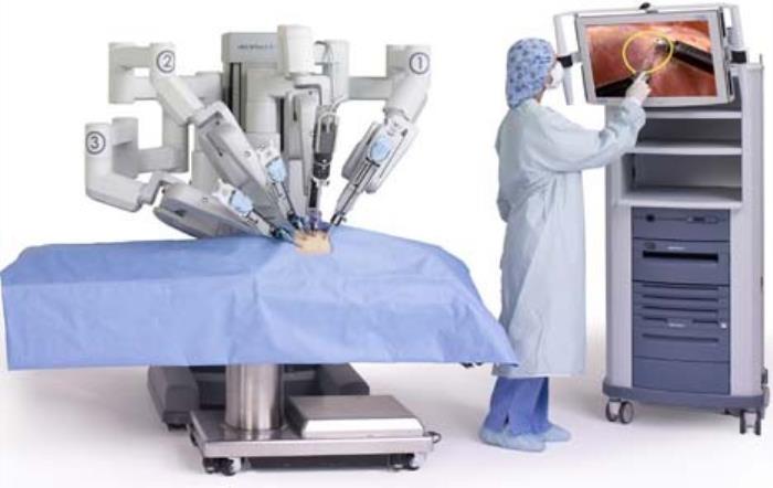 Robotic Surgery for Colon Cancer: An Innovative Approach