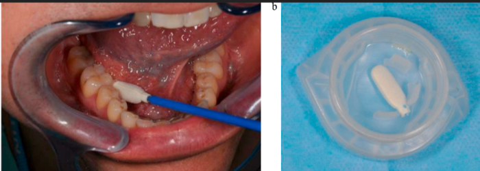 Non-Invasive Diagnostic Tools for Oral Cancer Detection - Salivary Biomarkers