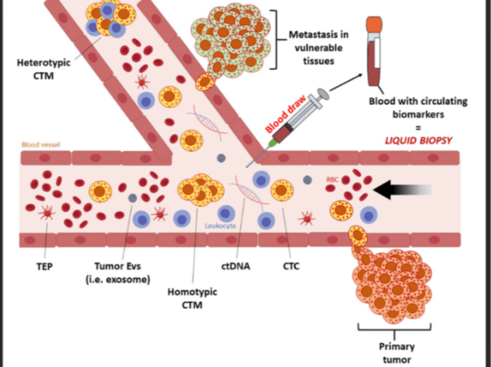 Non-Invasive Diagnostic Tools for Oral Cancer Detection - Liquid Biopsy