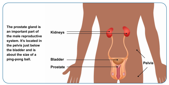 Prostate Cancer treatment in india