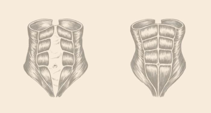 Role of Physical Therapy in Managing Diastasis Recti