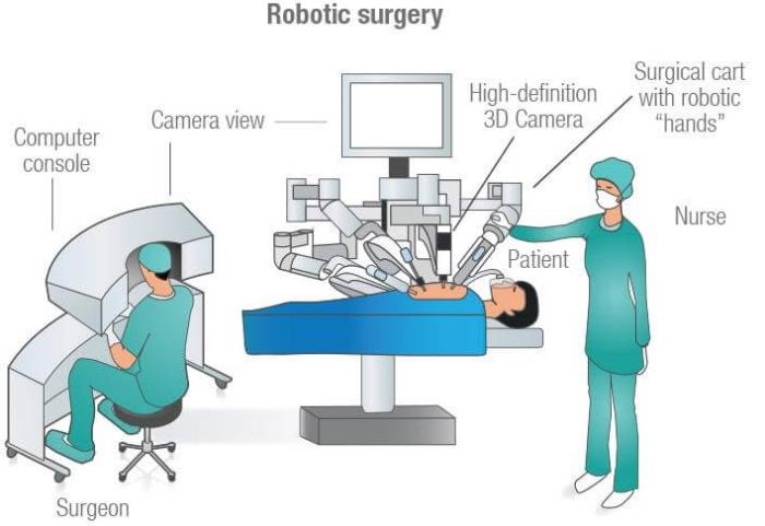 Robotic-Assisted Sleeve Gastrectomy: An Overview