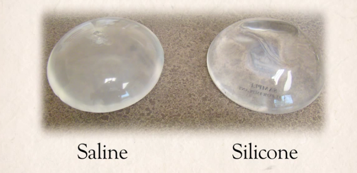 Silicone vs. Saline Implants