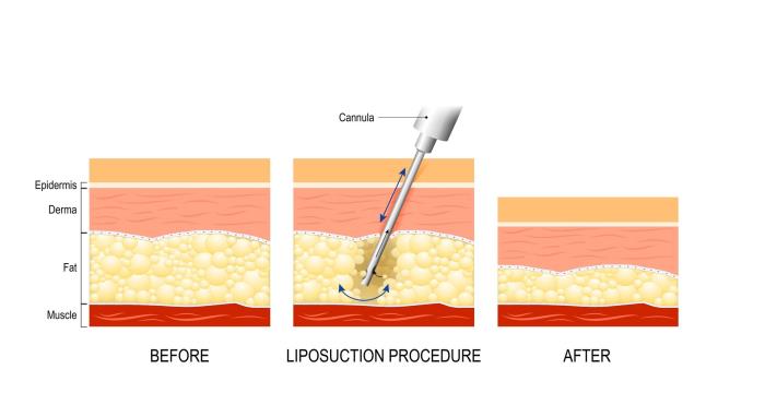 The Importance of Preoperative Preparation