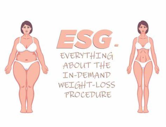 How ESG Helps with Weight Loss and Health Improvement