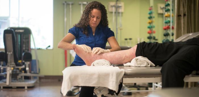 Importance of Occupational Therapy in Burn Recovery