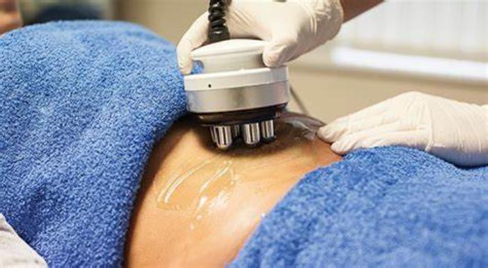 Radiofrequency Treatments for Body Contouring