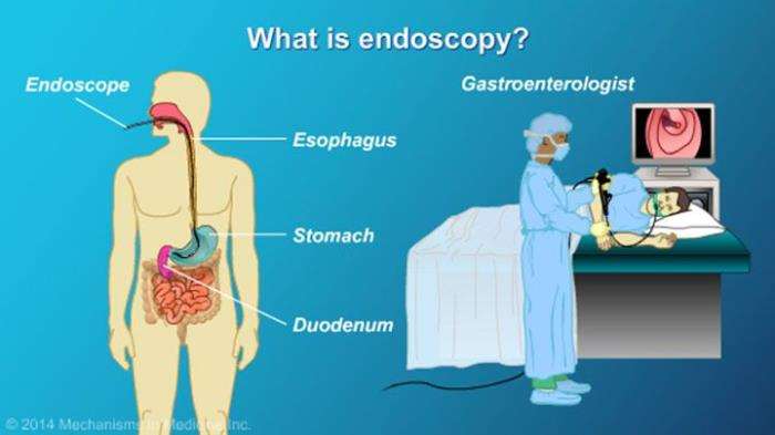 The Use of Endoscopy for Identifying Gastric Issues Before Surgery