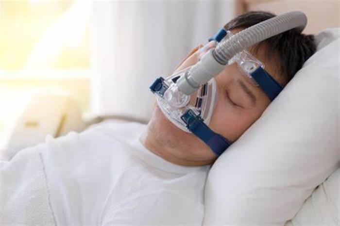 Effect of Mini Gastric Bypass on Sleep Apnea