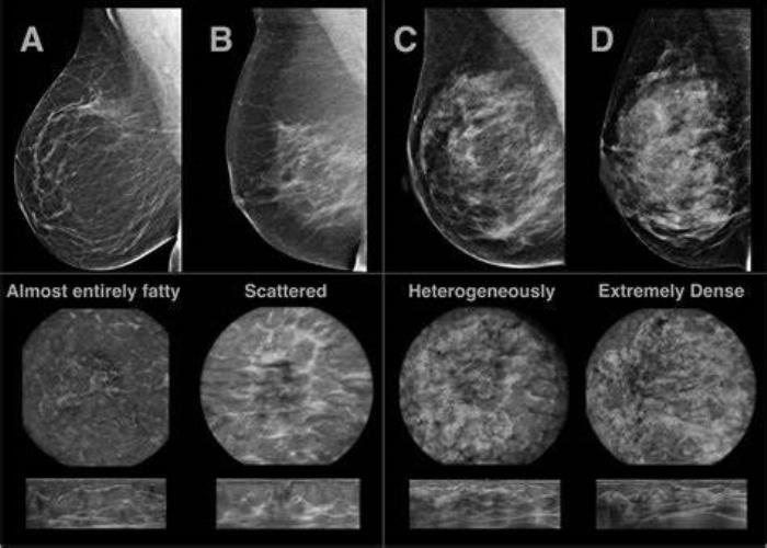 Role of 3D Imaging in Customizing Implant Selection