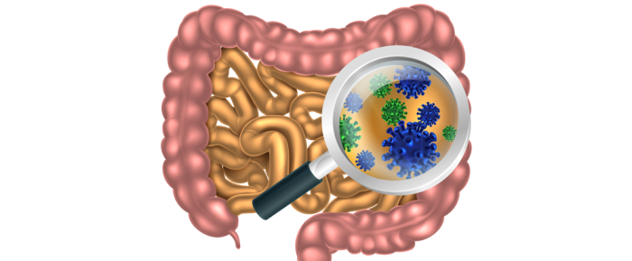 How Gastric Banding Influences Gut Bacteria Diversity