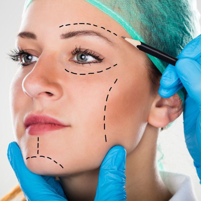 How can I minimize the appearance of scars after facelift surgery?