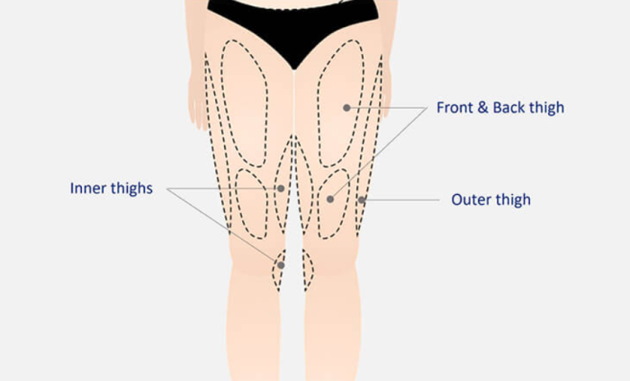 How Does Thigh Lift Surgery Compare to Other Body Contouring Procedures in Terms of Pain?