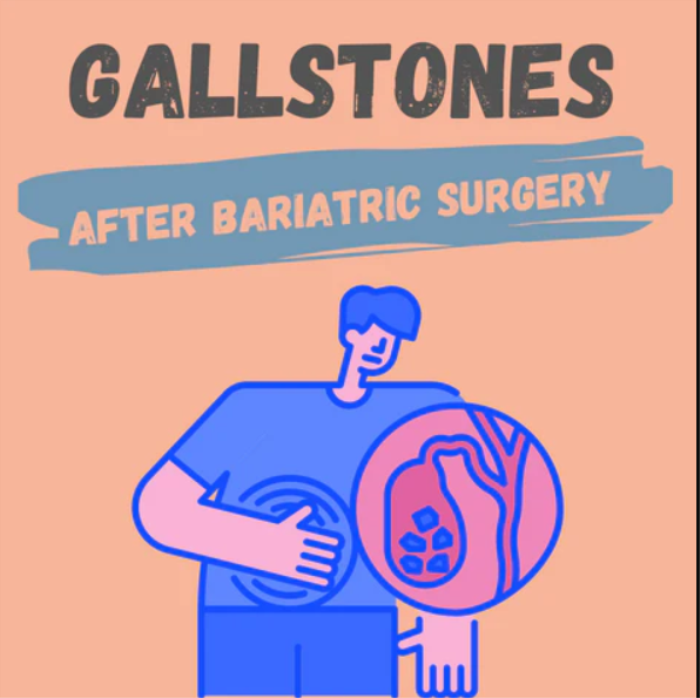 How Does the Risk of Gallstones Change After Revision Bariatric Surgery?