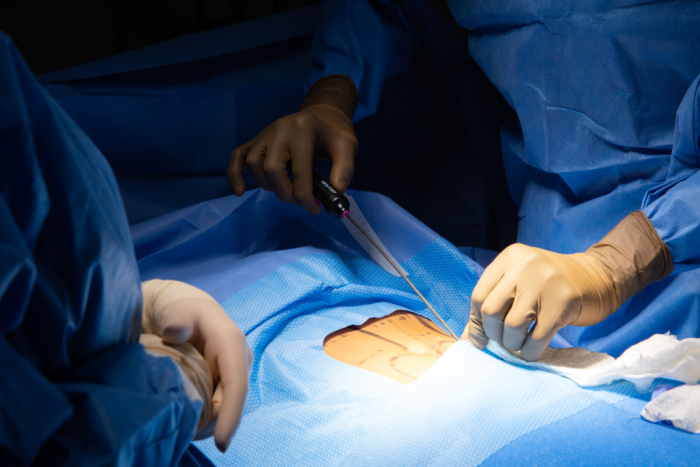 What is the total cost range for tummy tuck surgery, including hospital stay, in India?