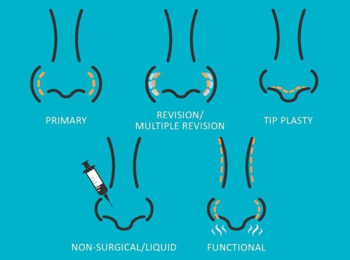 Best Rhinoplasty treatment in India