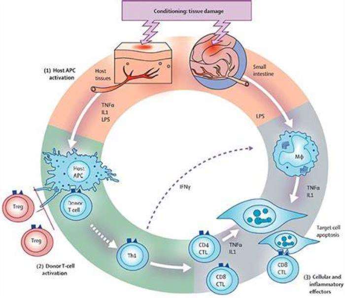 Risk Factors for Developing Graft-Versus-Host Disease