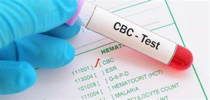 Role of Complete Blood Count (CBC) in Assessing Health