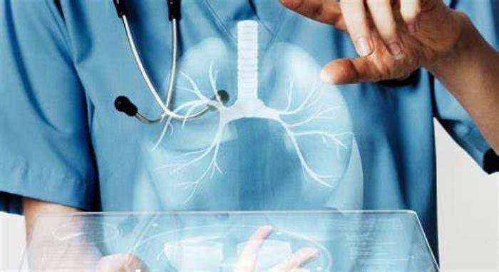 Individualized Rehabilitation Plans for Lung Transplant Patients