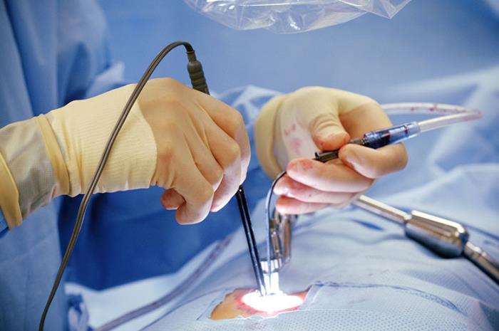 Minimally Invasive Approaches for Living Donor Liver Transplants