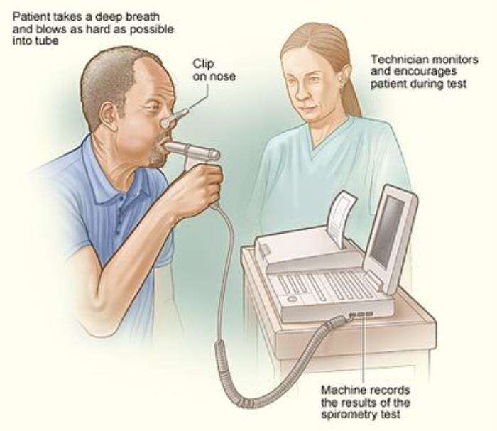 Assessing Lung Function: Key Pre-Transplant Tests