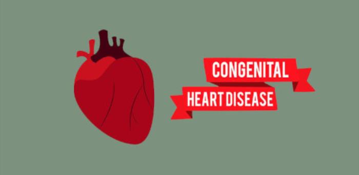 When Is Heart Transplantation Recommended for Congenital Heart Disease