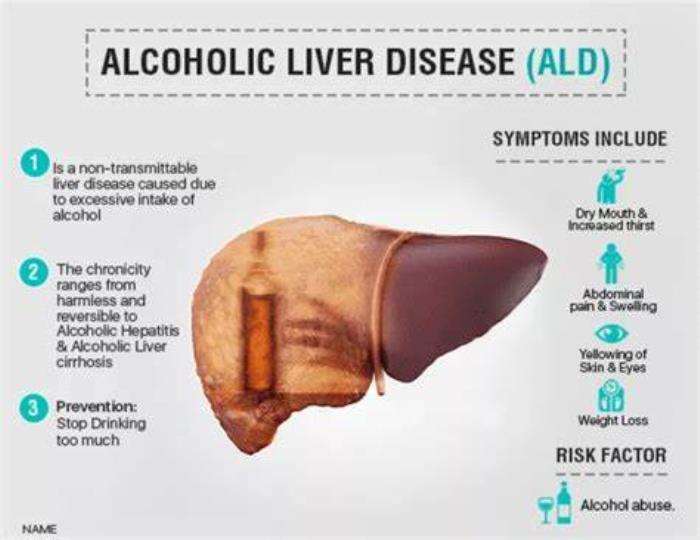 Managing Co-Existing Conditions in Alcoholic Liver Disease Patients