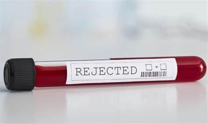 Laboratory Tests for Rejection Diagnosis