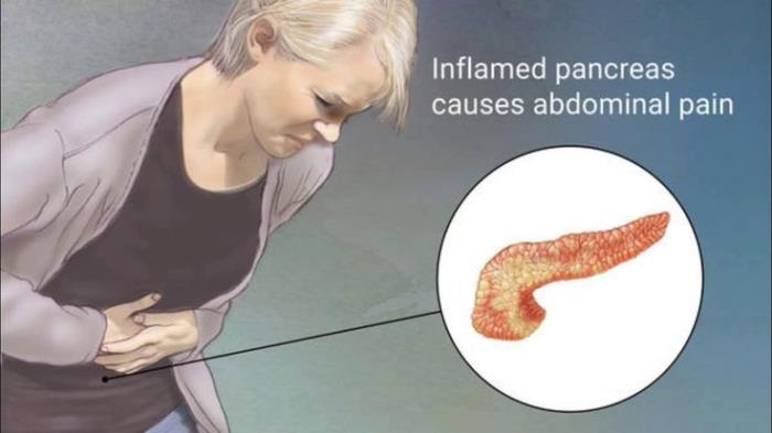 Common Symptoms Indicating Pancreatic Issues