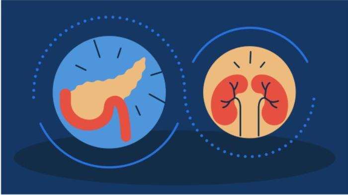 Simultaneous Pancreas-Kidney Transplantation