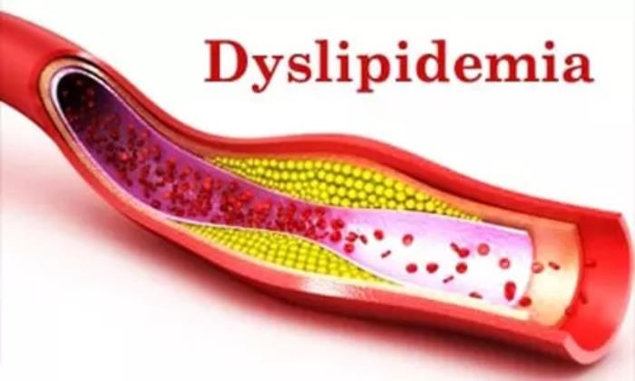 Dyslipidemia and Its Implications