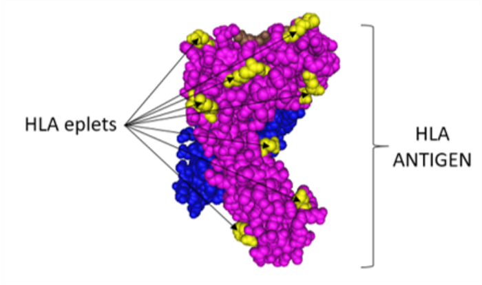 The Role of HLA in Immune Response