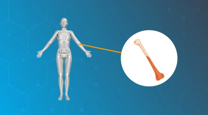 Understanding the Risks Associated with Bone Marrow Transplantation