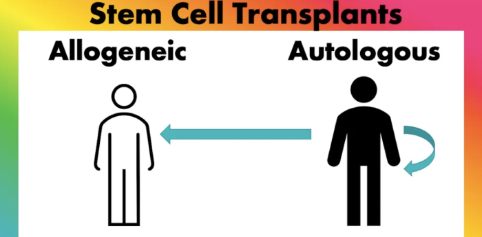 Types of Bone Marrow Transplants: Autologous vs. Allogeneic