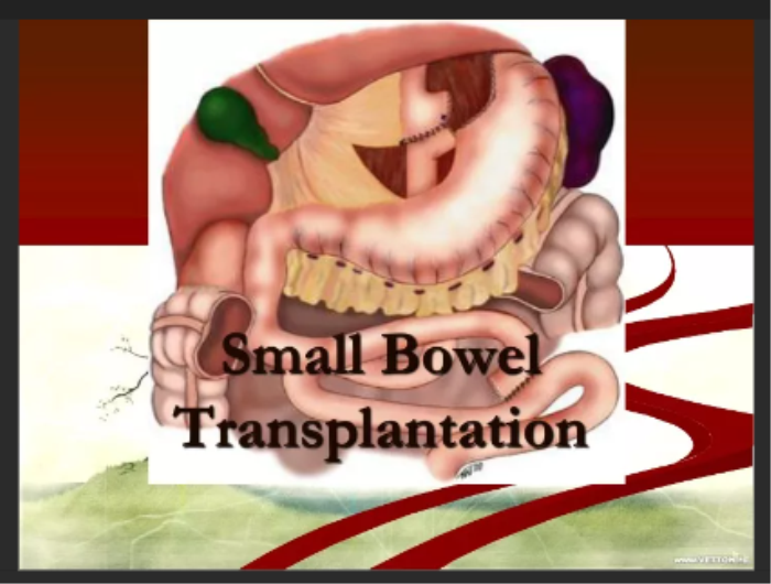 >Short Bowel Syndrome: Symptoms and Interventions