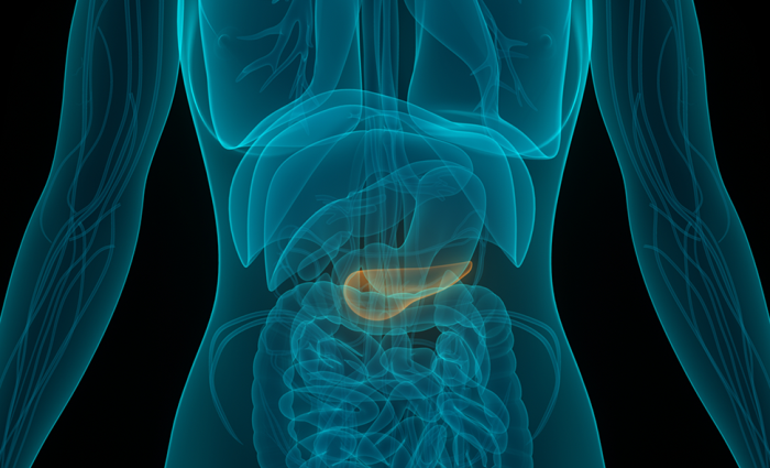 Challenges in Pancreas Transplantation for Chronic Pancreatitis Patients